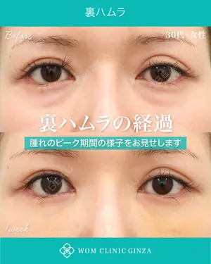 7 days after image