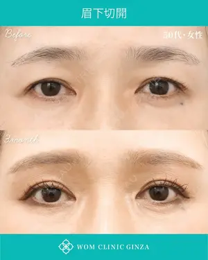 90 days after image