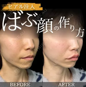 before image
