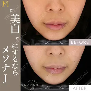 null days after image