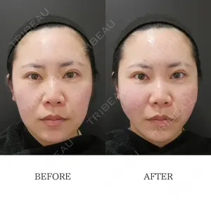 0 days after image