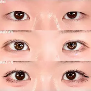 30 days after image