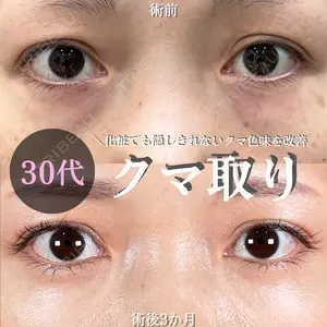 90 days after image