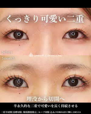 150 days after image