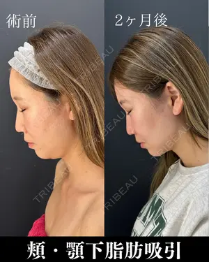 null days after image