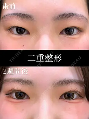 before image