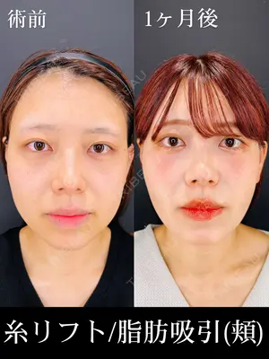 30 days after image