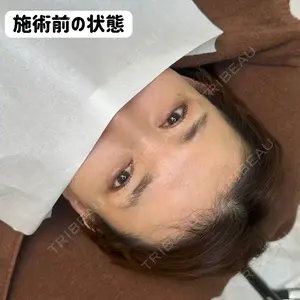 before image