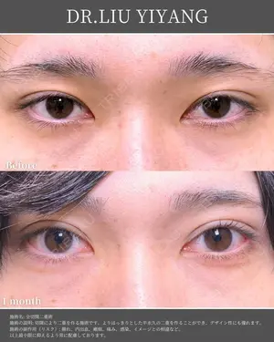 before image