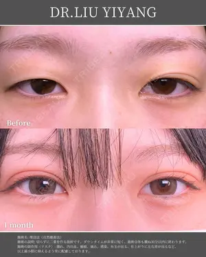 30 days after image