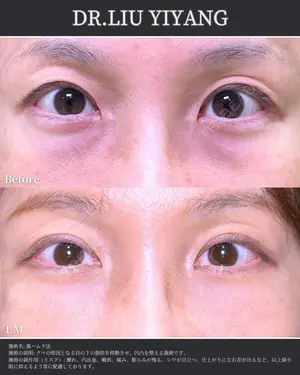 before image
