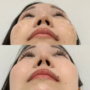 200 days after image