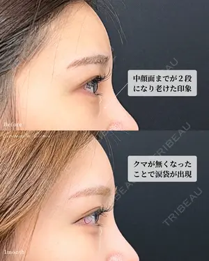 30 days after image