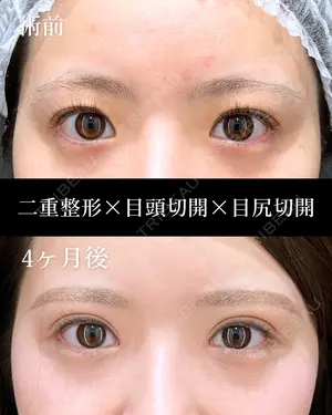 before image