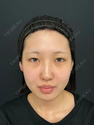 before image