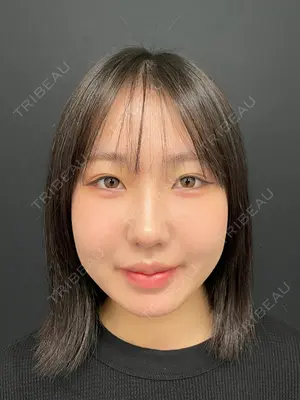 31 days after image