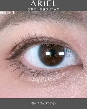 30 days after image