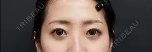 60 days after image