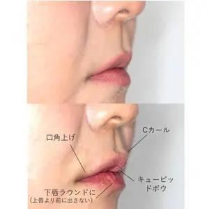 before image