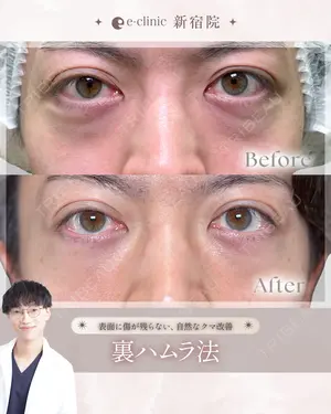 before image