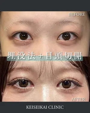before image
