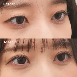 before image
