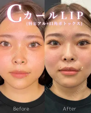0 days after image