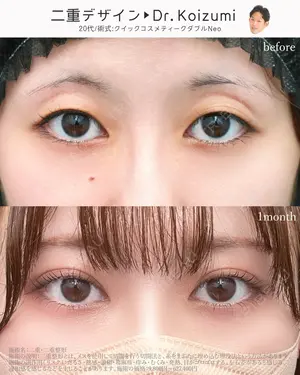 before image