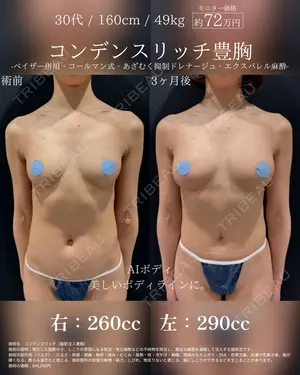 before image