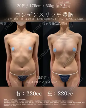 30 days after image