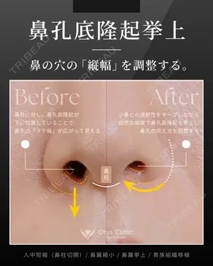 90 days after image