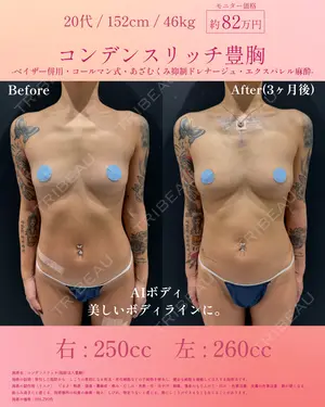 90 days after image