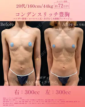 before image