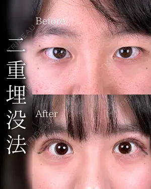 before image