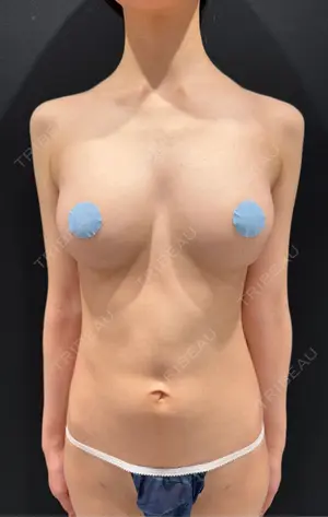 90 days after image
