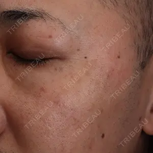30 days after image