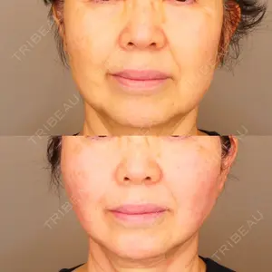 30 days after image