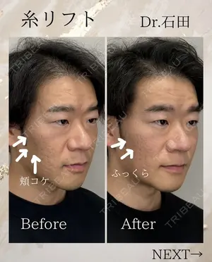 before image