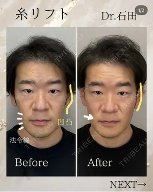 30 days after image