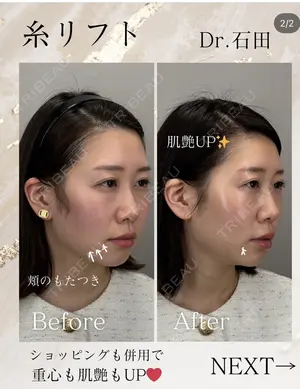 30 days after image