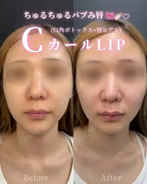 before image