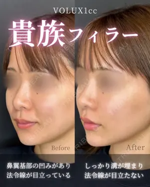 0 days after image