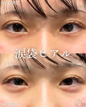 before image