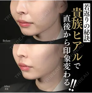 0 days after image