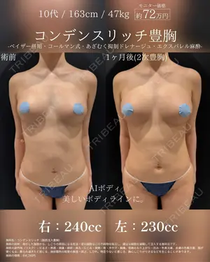 30 days after image