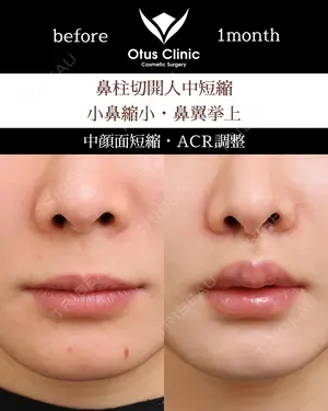 30 days after image