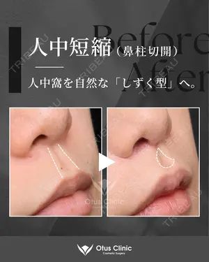 180 days after image