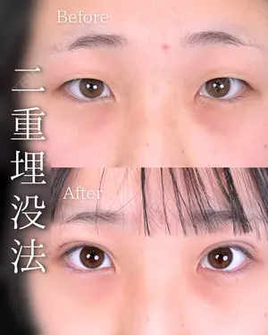 before image