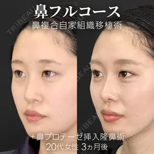 90 days after image