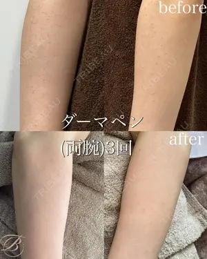89 days after image